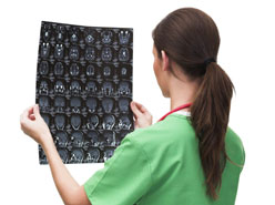 Diagnosis epilepsy